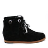 Lace Fashion Uggs